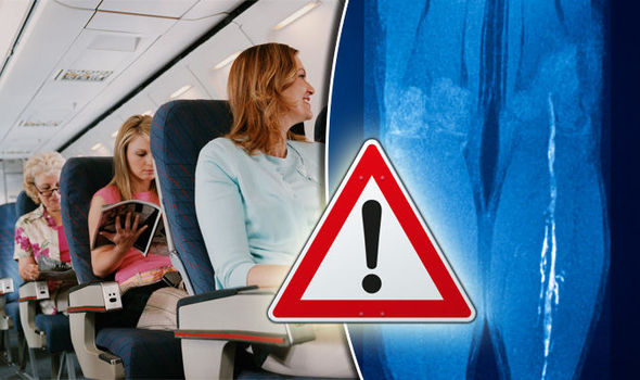 Izračunajte si riziko za razvoj tromboze med letalskim poletom